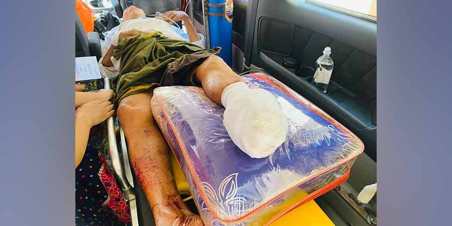 ရေးမြို့နယ်တွင်  အမျိုးသား ၁ ဦး မြေမြုပ်မိုင်းနင်းမိ