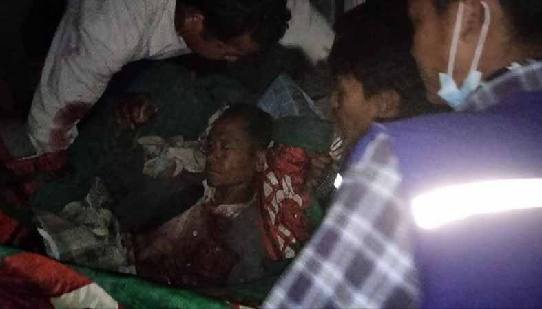 ပုဏ္ဏားကျွန်းမြို့နယ်၌  ကောက်ရသည့် ဗုံးသီးကို ဆော့ကစားရာက ပေါက်ကွဲပြီး ကလေး ၂ ဦးသေဆုံး