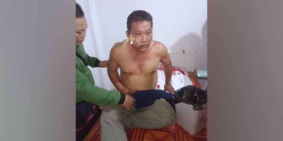 မြိတ်-ထားဝယ်ခရိုင်တွင် ကရင်လက်နက်ကိုင် ၂ ဖွဲ့ တိုက်ပွဲဖြစ်ပြီး နှစ်ဖက်တပ်ဖွဲ့ဝင်များ ထိခိုက်ကျဆုံး