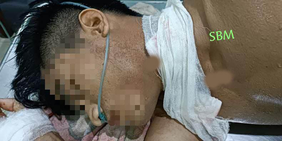 ကျိုက်ထိုတွင် စစ်တပ် လက်နက်ကြီး ပစ်ခတ်မှုကြောင့် ခြံလုပ်သား ၂ ဦးသေဆုံး၊ ၅ ဦးဒဏ်ရာရ