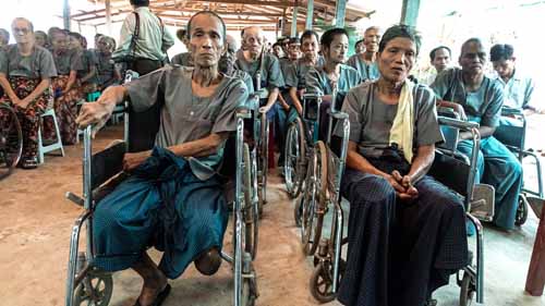 အနာႀကီးေရာဂါသည္မ်ား စား၀တ္ေနေရး အခက္ႀကံဳေန (သတင္းဓာတ္ပုံ)