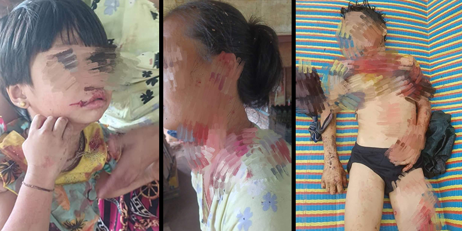 ကော့ကရိတ်တွင် စစ်တပ်က လက်နက်ကြီးပစ်ခတ်သဖြင့် ၁၂ နှစ်အရွယ် ကလေးငယ်သေဆုံး