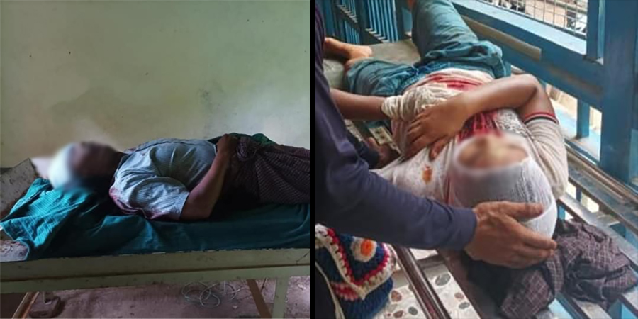 ကျောက်ကြီး ထွေအုပ်ရုံးတွင် ဗုံးပေါက်ကွဲ၊ စိုက်ပျိုးရေးဦးစီးမှူး သေဆုံးပြီး ၄ ဦး ဒဏ်ရာရ