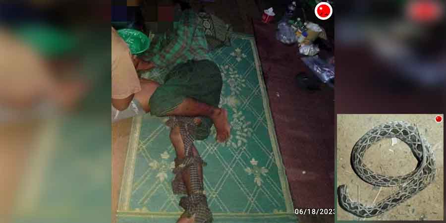 ကန့်ဘလူ စစ်ရှောင်များ မြွေဆိုးကိုက်ခံရသူ များပြားနေပြီး ဆရာဝန်နှင့် ဆေးဝါးလိုအပ်