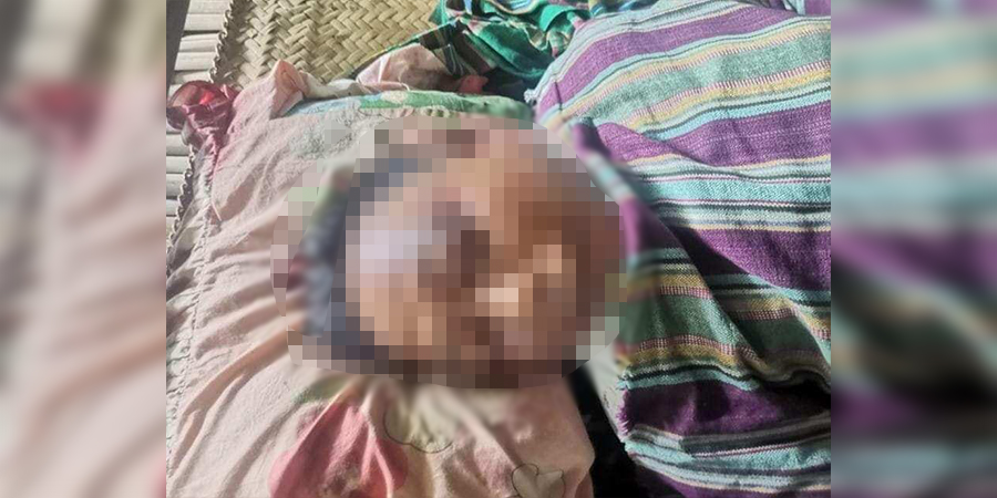 ပခုက္ကူတွင် လွှတ်တော်ကိုယ်စားလှယ်ဟောင်း ၁ ဦး ပစ်သတ်ခံရ