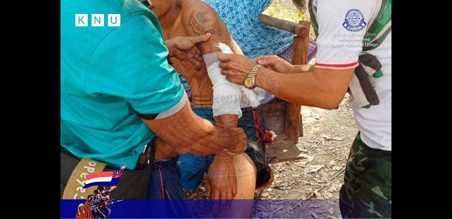 ဘီးလင်းတွင် စစ်တပ်ပစ်ခတ်မှုကြောင့် အမျိုးသား ၁ ဦး ဒဏ်ရာရ