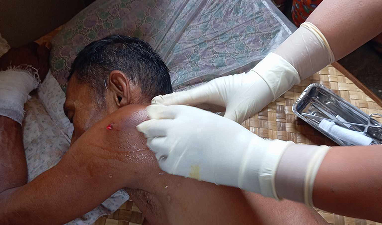 တနင်္သာရီတွင် စစ်တပ်လက်နက်ကြီးကြောင့် စစ်ရှောင် ပြည်သူ ၂ ဦး ဒဏ်ရာရ