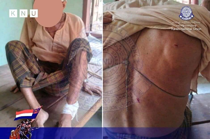 သထုံတွင် စစ်တပ်လက်နက်ကြီးကြောင့် ကလေး ၂ ဦး အပါအဝင် ၆ ဦးဒဏ်ရာရ