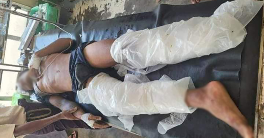 စဉ့်ကူးတွင် လက်နက်ကြီးထိပြီး အဘွားအိုသေ၊ အဘိုးအို ဒဏ်ရာရ၊ မုန်းမြို့တွင် လူငယ် ၁ ဦး မိုင်းနင်းပြီး ခြေထောက်ပြတ်