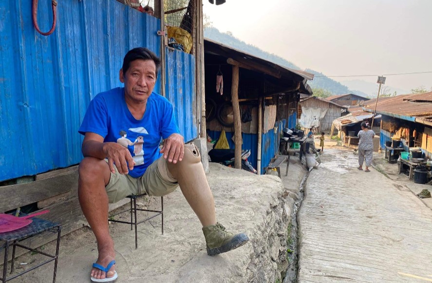 မြေမြှုပ်မိုင်းကြောင့် ခြေတဖက်ဆုံးရှုံးခဲ့ရတဲ့ ကချင် စစ်ဘေးရှောင်တဦး