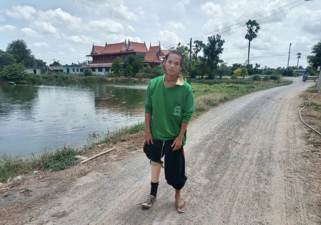 လုပ်ငန်းခွင်၌ ခြေတောက်ဖြတ်ခဲ့ရသည့် မြန်မာအလုပ်သမားကို ထိုင်းအလုပ်ရှင်က အပြည့်ဝ တာဝန် မယူ