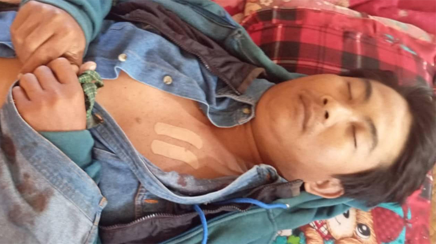 ကန့်ဘလူတွင် NUG ခန့် ကျေးရွာအုပ်ချုပ်ရေးမှူး ၁ ဦး ပစ်သတ်ခံရ
