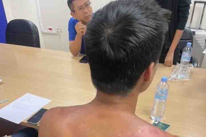 ထိုင်ဝမ်ပရော်ဖက်ရှင်နယ် မီးအကသမား မြန်မာကျားဖြန့်ဂိုဏ်းမှ ပြန်လွတ်မြောက်