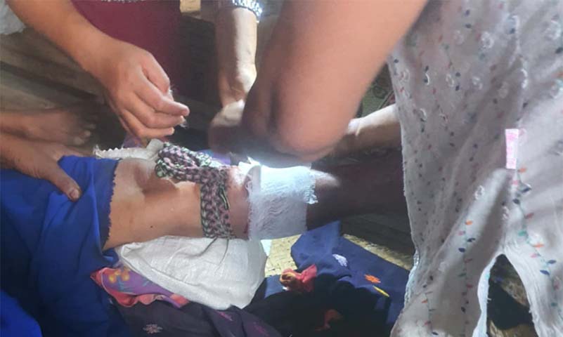 ကနီမြို့နယ်၌ စစ်တပ်လေကြောင်းတိုက်ခိုက်မှုကြောင့်  အမျိုးသမီး ၁ ဦးဒဏ်ရာရ 