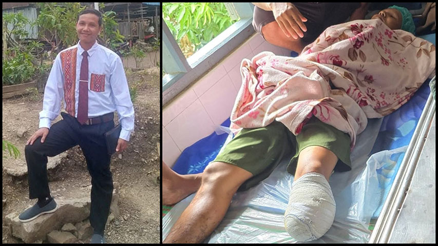 ကလေးမြို့နယ်၌ ခရစ်ယာန်တရားဟောဆရာတော် ၁ ပါး မိုင်းနင်းမိပြီး ခြေတဖက်ဖြတ်ရ