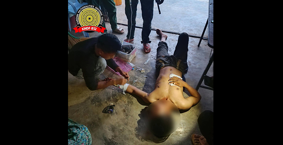 ကရင်နီ၊ လွိုင်လင်လေးကို စစ်ကောင်စီက လက်နက်ကြီးဖြင့်ပစ်ခတ်၊ ပြည်သူ ၄ ဦး ဒဏ်ရာရ