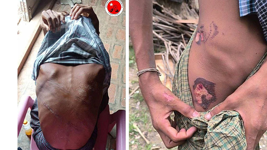 ရွှေတွင်းလုပ်သား ၇ ဦးကို စစ်တပ်က ဖမ်းဆီးနှိပ်စက်ပြီး မီးရှို့သတ်၊ ၁ ဦး လွတ်မြောက်