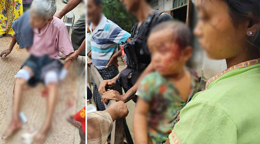 ပေါက်မြို့နယ်၌ စစ်ဘေးရှောင်တဲကို စစ်တပ်က ဗုံးကြဲ၊ ကလေးငယ်အပါအဝင် ၃ ဦး ဒဏ်ရာရ
