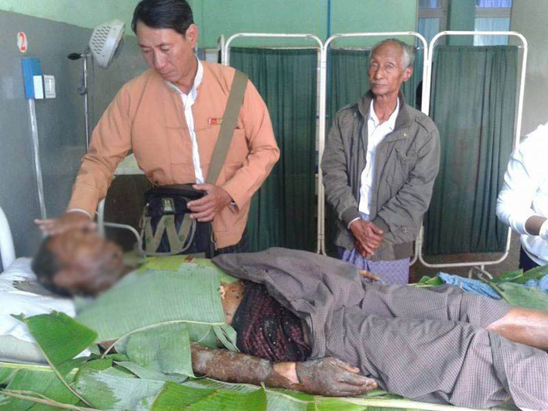 ရွမ္းျပည္နယ္မွ လယ္သိမ္းခံေတာင္သူတဦး မိမိကိုယ္ကို မီး႐ႈိ႕ဆႏၵျပ